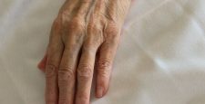 Почему появляются преждевременные признаки старения и что с этим делать? Рассказывает телесный терапевт